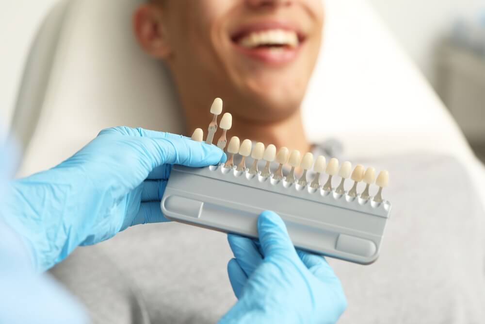 what are dental veneers cost, procedure & advantages